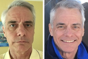 X39 before and after use